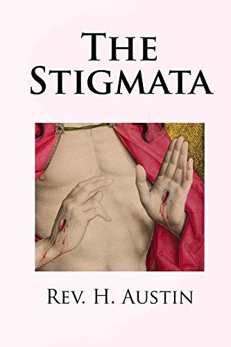 The Stigmata: A history of various cases.