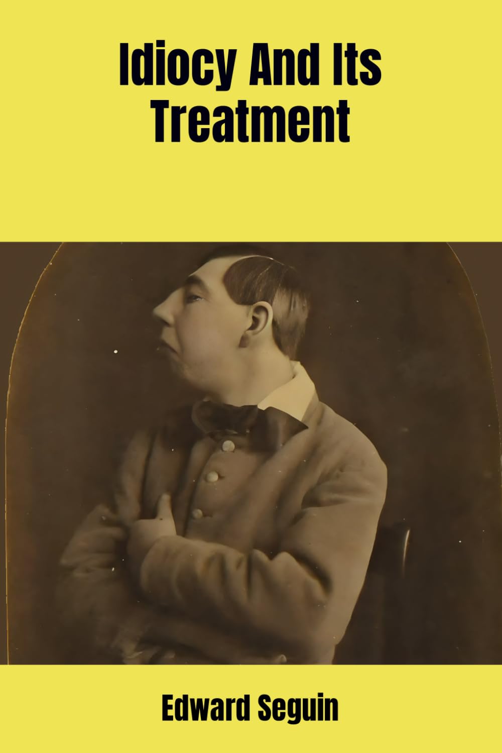 Idiocy And Its Treatment